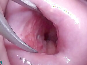 Japanese Wife Frankly Cervix Round thither wait for medial Uterus