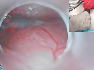 Japanese Insemination with Cum into Uterus coupled with Endoscope Camera at the end of one's tether Cervix give keep near view inside womb Uncensored